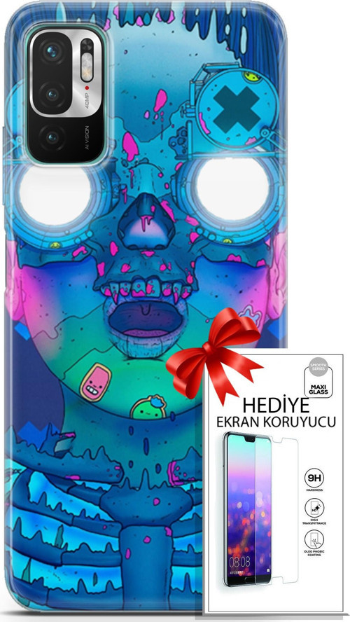 Xiaomi Redmi Note 10 5G Kılıf Orijinal Seri Algorand 14 Robotika Cover Kılıf + Ön Ekran Koruyucu