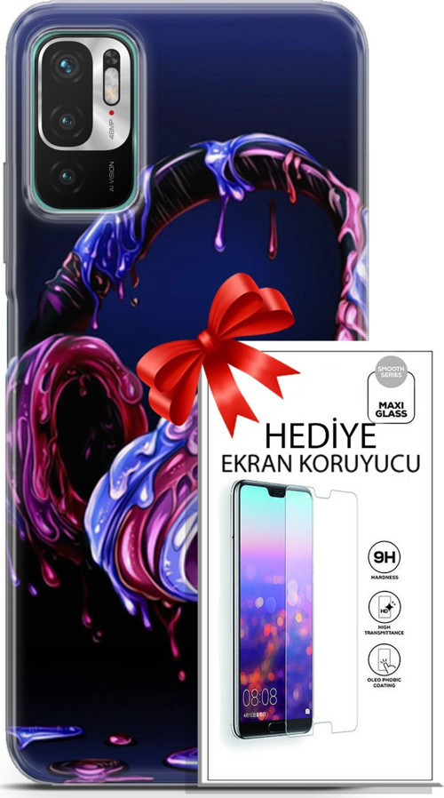 Xiaomi Redmi Note 10 5G Kılıf Orijinal Seri Cardano 14 Kulaklık Cover Kılıf + Ön Ekran Koruyucu