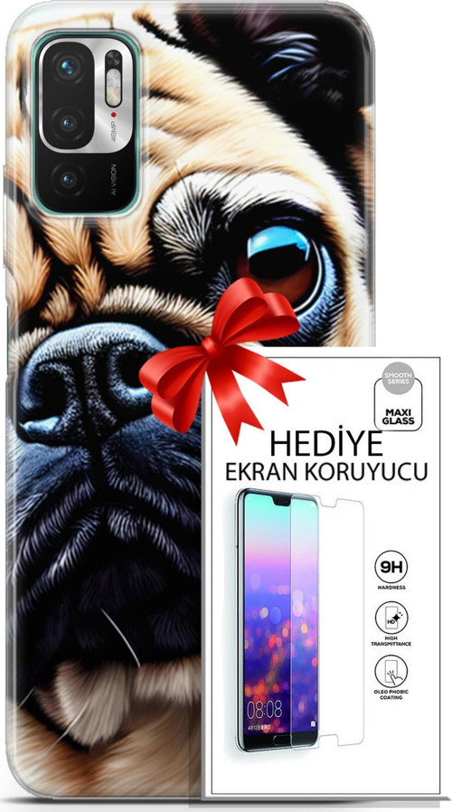 Xiaomi Redmi Note 10 5G Kılıf Orijinal Seri Dogs 08 Pug Baskılı Kılıf + Ekran Koruyucu