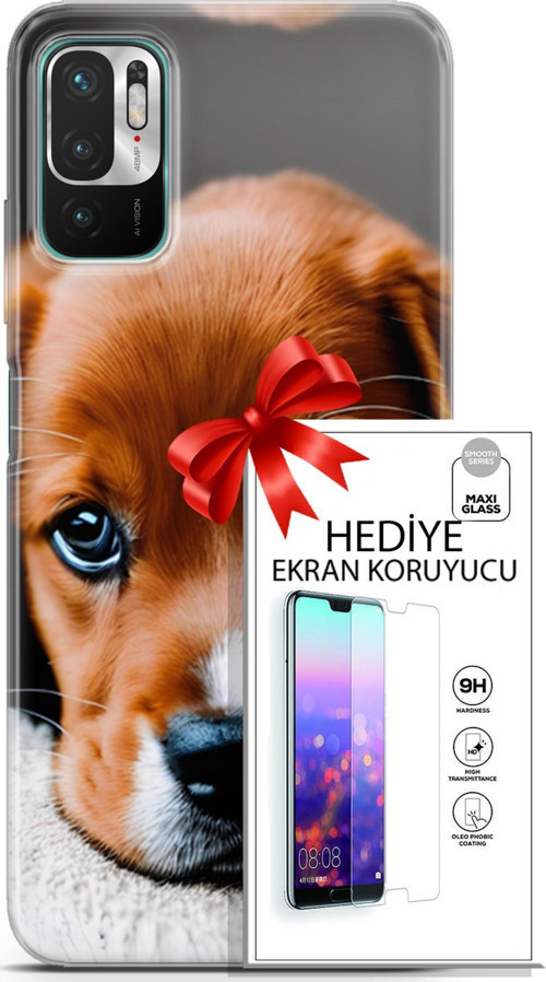 Xiaomi Redmi Note 10 5G Kılıf Orijinal Seri Dogs 09 Beagle Uv Kılıf Ve Ekran Koruyucu