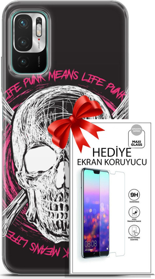Xiaomi Redmi Note 10 5G Kılıf Orijinal Seri Punky 10 Punk Kurukafa Full Hd Kılıf + Ekran Koruyucu