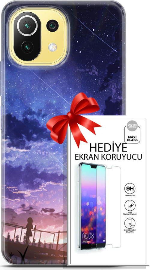 Xiaomi 11 Lite 5G Kılıf Orijinal Seri Fantasy 09 Kayan Yıldızlar Uv Kılıf Ve Ekran Koruyucu