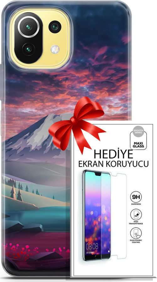 Xiaomi 11 Lite 5G Kılıf Orijinal Seri Fantasy 14 Karlı Dağ Cover Kılıf + Ön Ekran Koruyucu