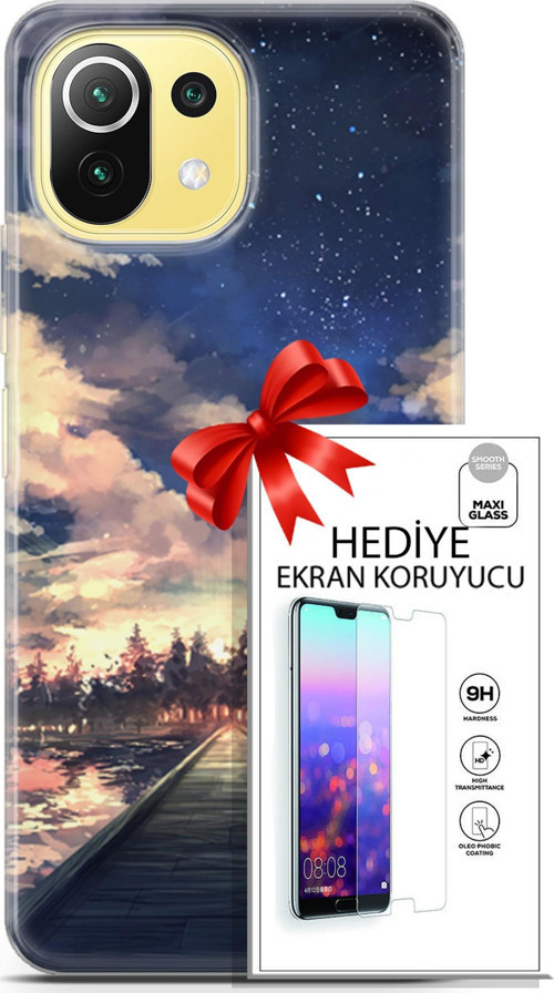 Xiaomi 11 Lite 5G Kılıf Orijinal Seri Fantasy 22 Sonsuz Yol Kap + Ekran Koruyucu