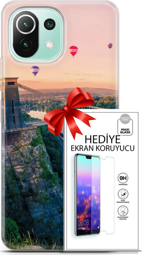 Xiaomi 11 Lite 5G Ne Kılıf Orijinal Seri Fantasy 07 Köprü Balonlar Desenli Kılıf + Ön Ekran Koruyucu