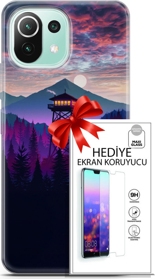 Xiaomi 11 Lite 5G Ne Kılıf Orijinal Seri Fantasy 17 Orman Kule Yumuşak Kılıf + Ekran Koruyucu