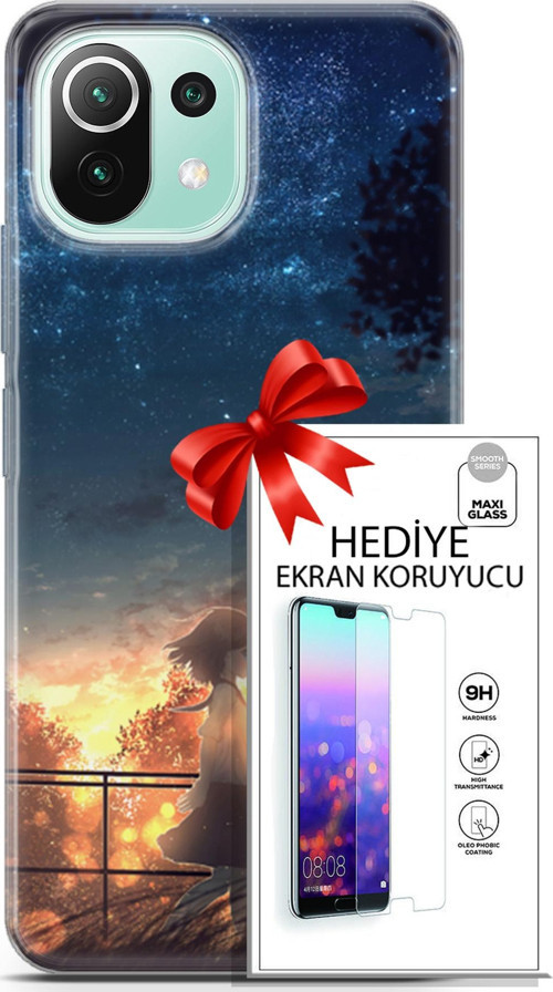 Xiaomi 11 Lite 5G Ne Kılıf Orijinal Seri Fantasy 21 Anime Yıldızlar Darbe Önleyici Kapak + Ön Ekran Koruyucu
