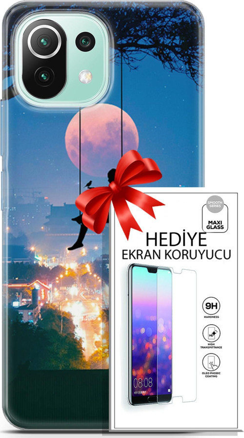 Xiaomi 11 Lite 5G Ne Kılıf Orijinal Seri Fantasy 30 Ay Salıncak Kenarları Şeffaf Kapak Ve Ekran Koruyucu