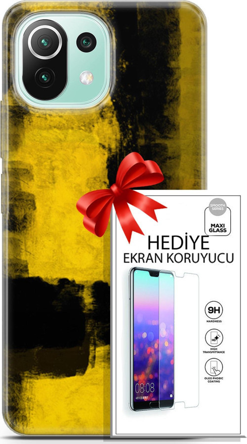 Xiaomi 11 Lite 5G Ne Kılıf Orijinal Seri Nature 08 Sarı Siyah Baskılı Kılıf + Ekran Koruyucu