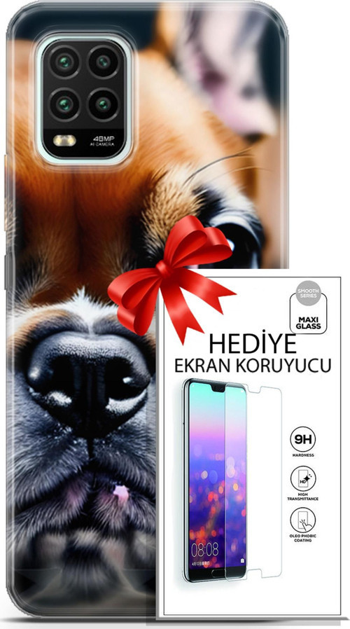 Xiaomi Mi 10 Lite 5G Kılıf Orijinal Seri Dogs 10 İngiliz Mastiff Full Hd Kılıf + Ekran Koruyucu