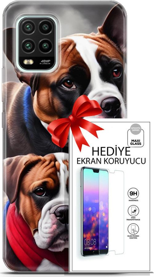 Xiaomi Mi 10 Lite 5G Kılıf Orijinal Seri Dogs 25 Alman Boksör Soyulmayan Kılıf + Ekran Koruyucu Full