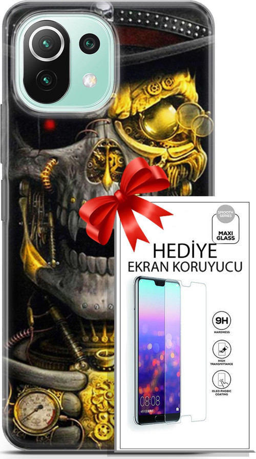 Xiaomi 11 Lite 5G Ne Kılıf Orijinal Seri Pubg 22 Skeleton Kap + Ekran Koruyucu