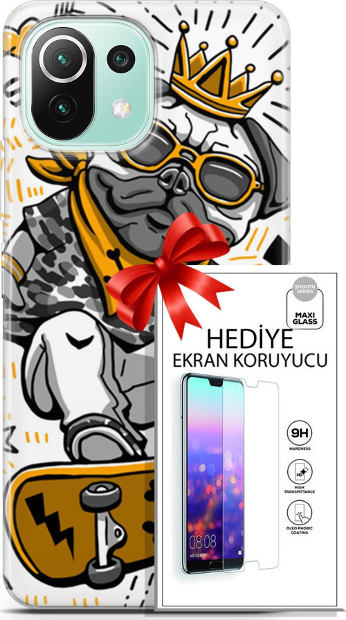 Xiaomi 11 Lite 5G Ne Kılıf Orijinal Seri Punky 09 Punk Pug Uv Kılıf Ve Ekran Koruyucu