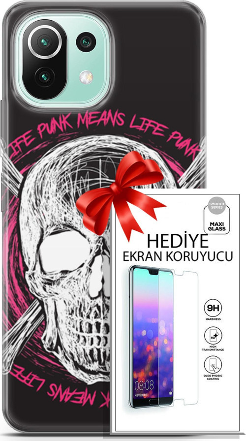 Xiaomi 11 Lite 5G Ne Kılıf Orijinal Seri Punky 10 Punk Kurukafa Full Hd Kılıf + Ekran Koruyucu