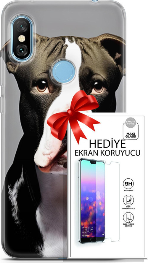 Xiaomi Redmi Note 6 Pro Kılıf Orijinal Seri Dogs 24 American Pitbull Darbe Emici Kılıf + Ekran Koruyucu