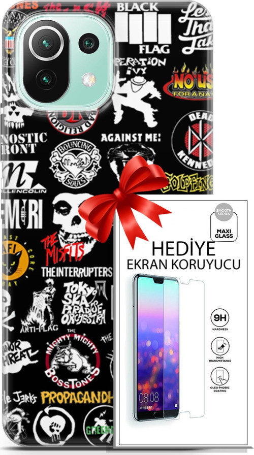 Xiaomi 11 Lite 5G Ne Kılıf Orijinal Seri Punky 29 Armalar Leke Tutmaz Kapak + Ekran Koruyucu