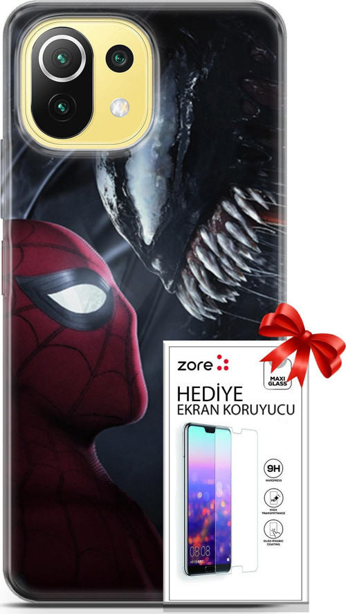 Xiaomi 11 Lite 5G Kılıf Orijinal Seri Supers 09 Spider-Man Vs Venom Uv Kılıf Ve Ekran Koruyucu