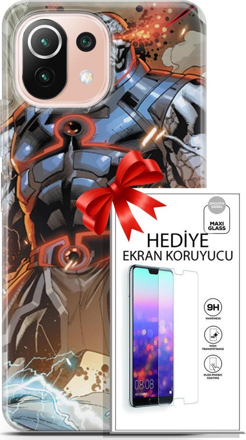 Xiaomi Mi 11 Lite Kılıf Orijinal Seri Dc 09 Darkseid Uv Kılıf Ve Ekran Koruyucu