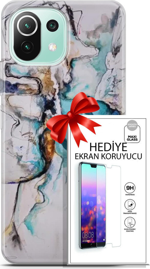 Xiaomi 11 Lite 5G Ne Kılıf Orijinal Seri Soul 11 Turkuaz 4K Baskılı Kılıf + Ekran Koruyucu Full Koruma