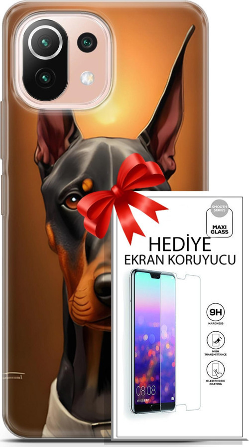 Xiaomi Mi 11 Lite Kılıf Orijinal Seri Dogs 03 Doberman Arka Kapak + Ekran Koruyucu