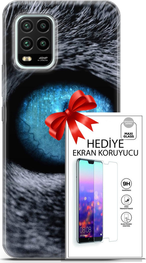 Xiaomi Mi 10 Lite 5G Kılıf Orijinal Seri Scotish-British 29 Pov Eye Leke Tutmaz Kapak + Ekran Koruyucu