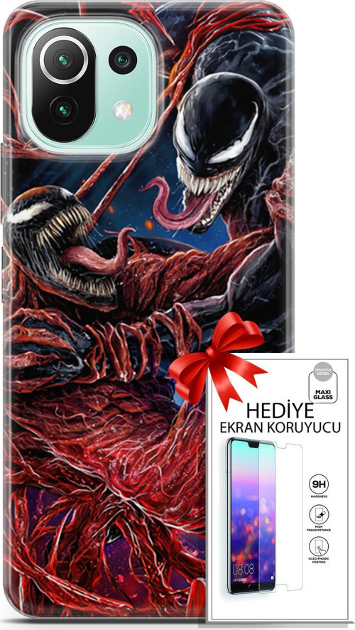 Xiaomi 11 Lite 5G Ne Kılıf Orijinal Seri Cardano 22 Monsters Kap + Ekran Koruyucu