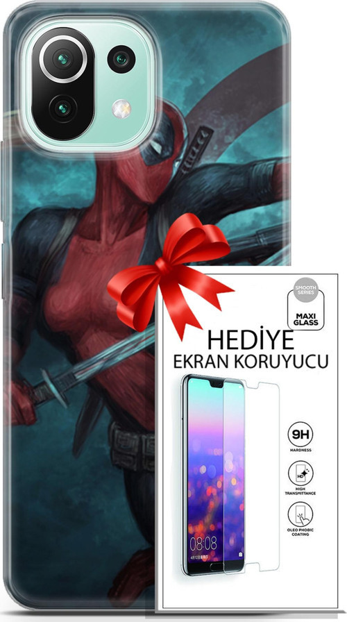Xiaomi 11 Lite 5G Ne Kılıf Orijinal Seri Dc 28 Örümcek Kız İz Bırakmayan Kılıf + Ön Ekran Koruyucu