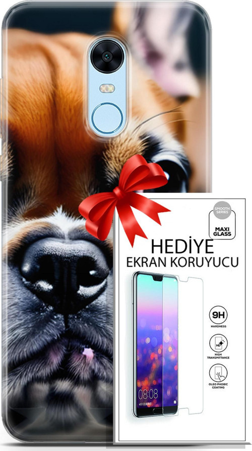 Xiaomi Redmi 5 Plus Kılıf Orijinal Seri Dogs 10 İngiliz Mastiff Full Hd Kılıf + Ekran Koruyucu