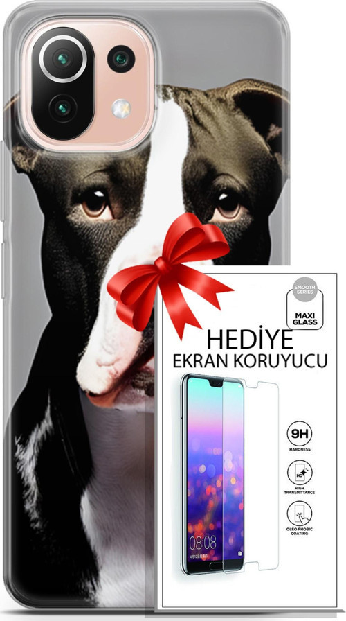 Xiaomi Mi 11 Lite Kılıf Orijinal Seri Dogs 24 American Pitbull Darbe Emici Kılıf + Ekran Koruyucu