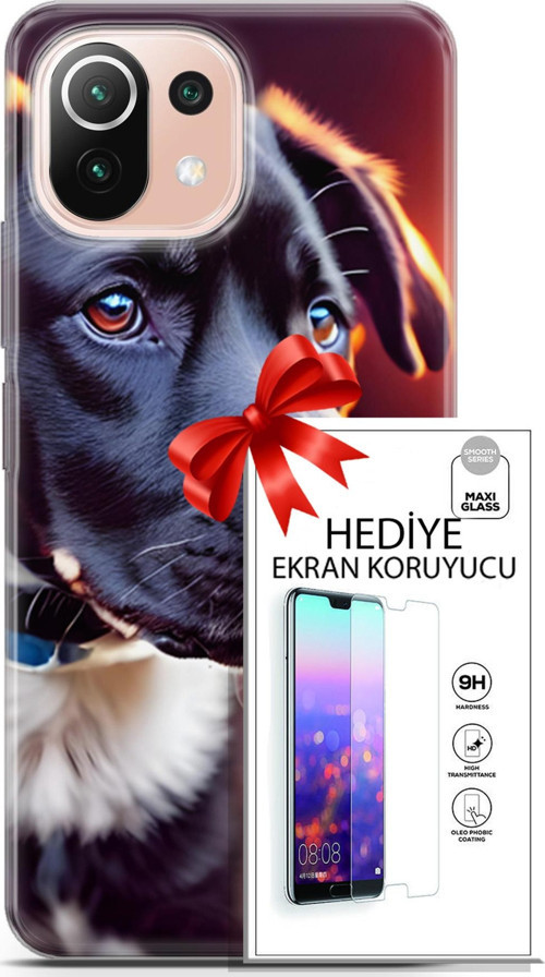 Xiaomi Mi 11 Lite Kılıf Orijinal Seri Dogs 27 Rostov Lazer Kesim Silikon Ekran Koruyucu