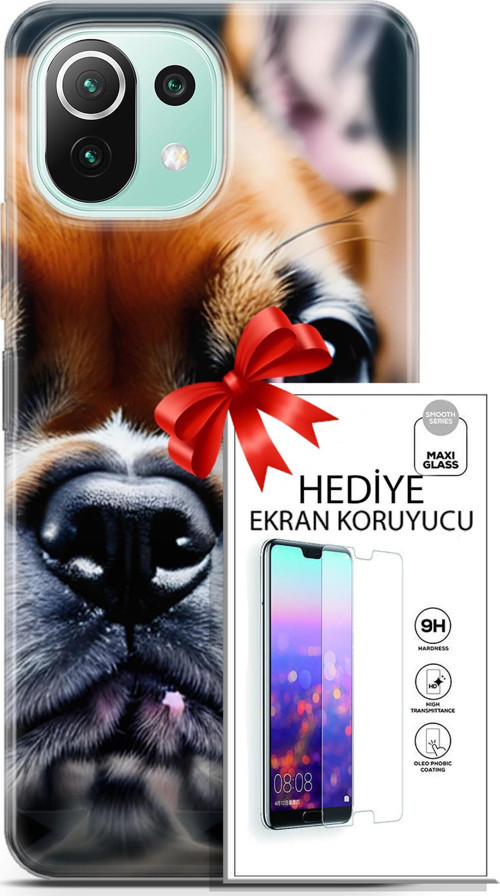 Xiaomi 11 Lite 5G Ne Kılıf Orijinal Seri Dogs 10 İngiliz Mastiff Full Hd Kılıf + Ekran Koruyucu