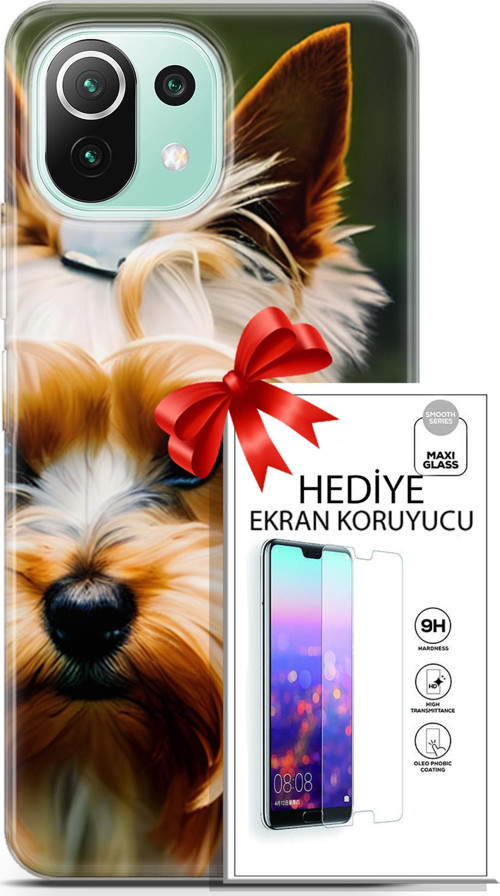 Xiaomi 11 Lite 5G Ne Kılıf Orijinal Seri Dogs 13 Yorkshire Terriyer Case Kapak Ekran Koruyucu