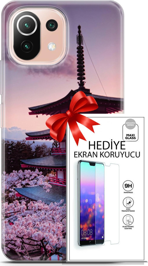 Xiaomi Mi 11 Lite Kılıf Orijinal Seri Fantasy 04 Arakurayama Sengen Silikon Kılıf + Ekran Koruyucu F