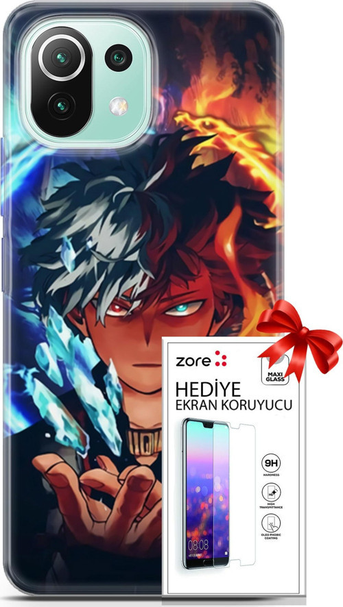 Xiaomi 11 Lite 5G Ne Kılıf Orijinal Seri Supers 13 Todoraki Anime Case Kapak Ekran Koruyucu