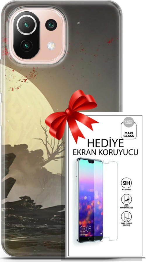 Xiaomi Mi 11 Lite Kılıf Orijinal Seri Fantasy 29 Anime Savaşçı Leke Tutmaz Kapak + Ekran Koruyucu