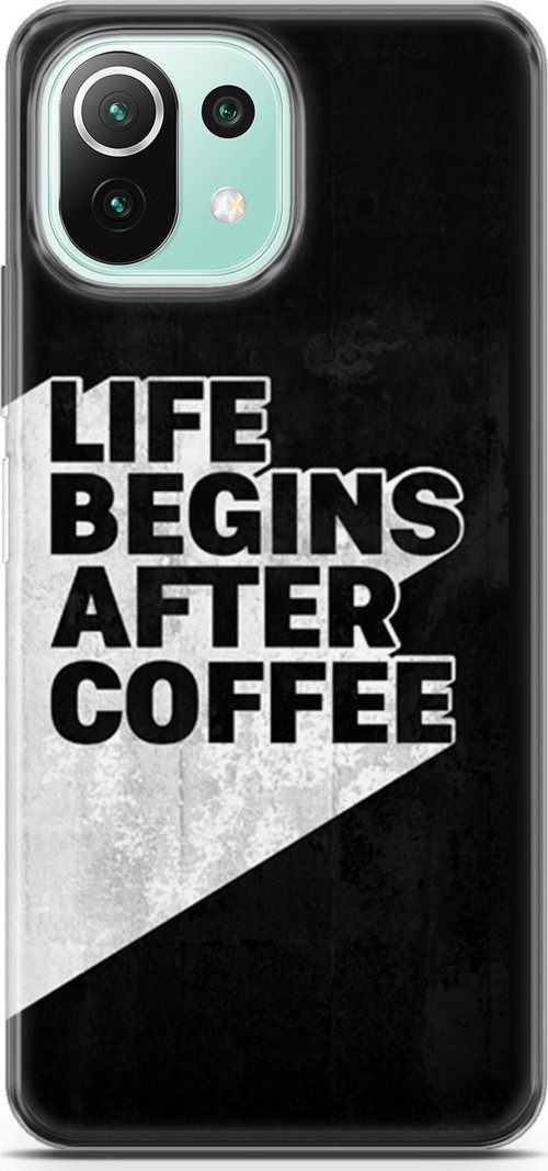 Xiaomi 11 Lite 5G Ne Kılıf Orijinal Seri Typo 02 Life Begins After Coffee Kapak