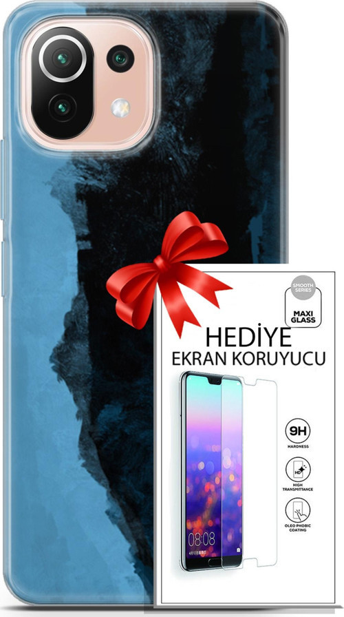 Xiaomi Mi 11 Lite Kılıf Orijinal Seri Nature 24 Mavi Siyah Darbe Emici Kılıf + Ekran Koruyucu