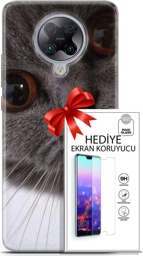 Xiaomi Poco F2 Pro Kılıf Orijinal Seri Scotish-British 11 Pov British 4K Baskılı Kılıf + Ekran Koruyucu
