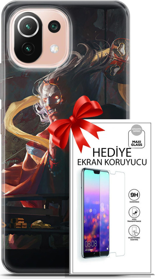 Xiaomi Mi 11 Lite Kılıf Orijinal Seri Neo 07 Batman Vs Deathstroke Desenli Kılıf + Ön Ekran Koruyucu