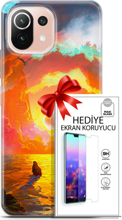 Xiaomi Mi 11 Lite Kılıf Orijinal Seri Neo 21 Tabancalı Darbe Önleyici Kapak + Ön Ekran Koruyucu