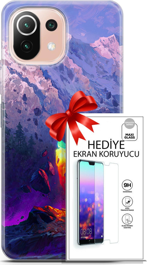 Xiaomi Mi 11 Lite Kılıf Orijinal Seri Neo 24 Örümcek Adam Darbe Emici Kılıf + Ekran Koruyucu