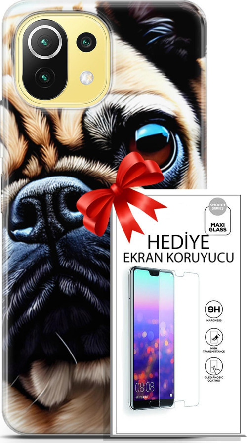 Xiaomi 11 Lite 5G Kılıf Orijinal Seri Dogs 08 Pug Baskılı Kılıf + Ekran Koruyucu