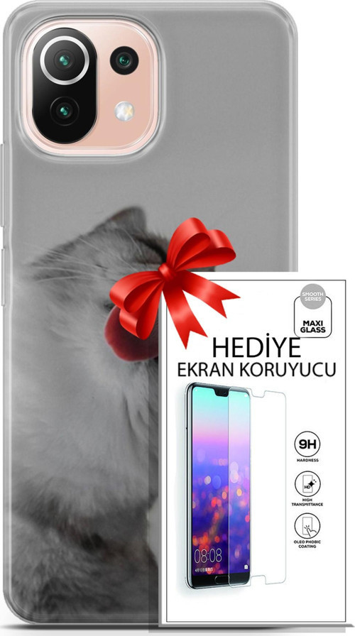 Xiaomi Mi 11 Lite Kılıf Orijinal Seri Scotish-British 07 British Shorthair Desenli Kılıf + Ön Ekran Koruyucu