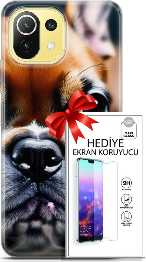 Xiaomi 11 Lite 5G Kılıf Orijinal Seri Dogs 10 İngiliz Mastiff Full Hd Kılıf + Ekran Koruyucu
