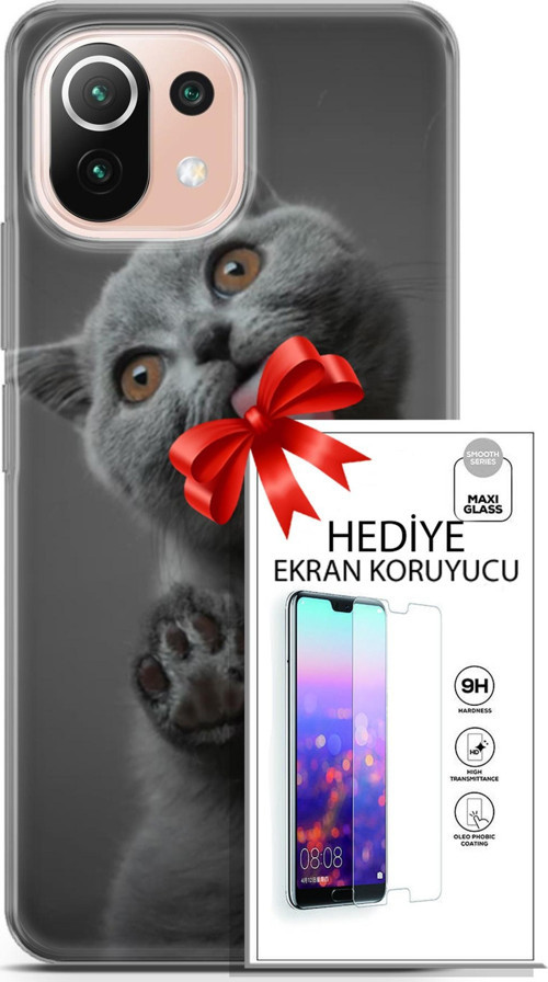 Xiaomi Mi 11 Lite Kılıf Orijinal Seri Scotish-British 09 Yavru Kedi Uv Kılıf Ve Ekran Koruyucu