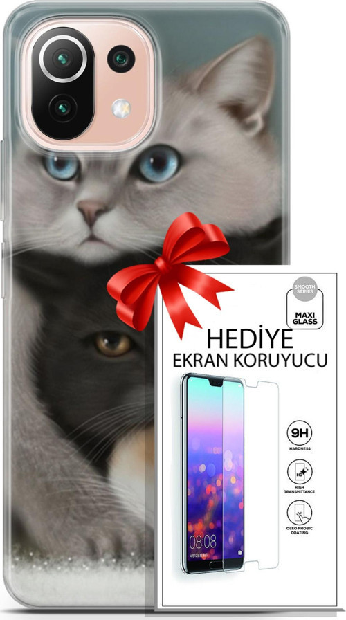 Xiaomi Mi 11 Lite Kılıf Orijinal Seri Scotish-British 13 Beyaz Gri Kahve Kediler Case Kapak Ekran Koruyucu