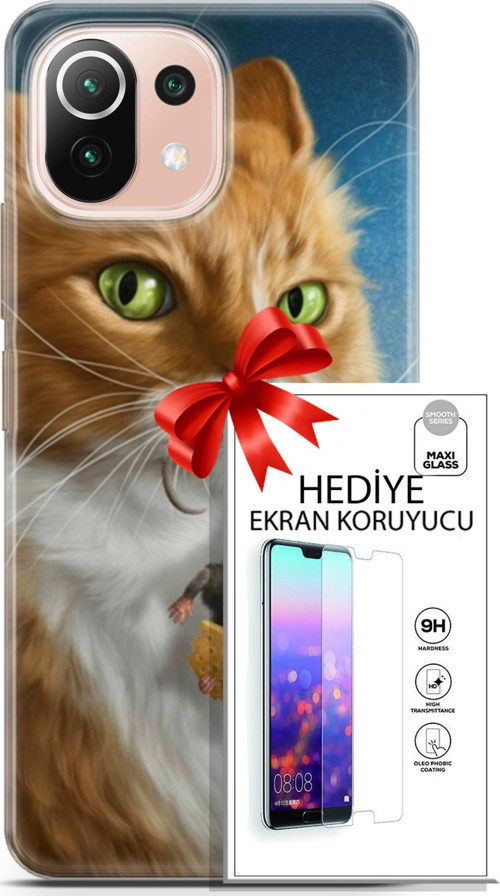 Xiaomi Mi 11 Lite Kılıf Orijinal Seri Scotish-British 14 Sibirya Kedisi Avcı Cover Kılıf + Ön Ekran Koruyucu