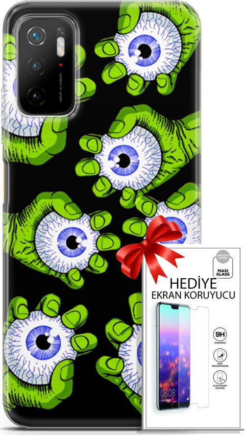 Xiaomi Poco M3 Pro Kılıf Orijinal Seri Bounce 23 Lynn Walsh Telefon Kabı Ve Ekran Koruyucu