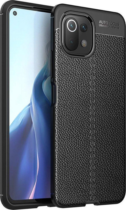 Xiaomi Mi 11 Lite Kılıf Focus Derili Silikon - Siyah