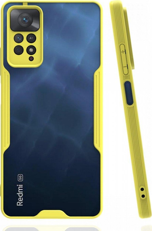 Xiaomi Redmi Note 11 Pro Kılıf Platin Silikon